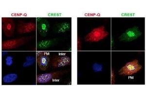 Immunofluorescence microscopy using  protein A purified anti-CENP-Q antibody shows detection of endogenous CENP-Q in HeLa whole cell lysate. (CENPQ antibody)