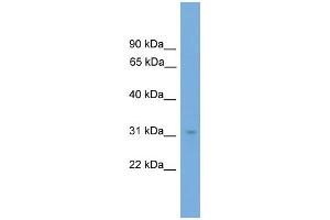 WB Suggested Anti-NRBF2  Antibody Titration: 0.