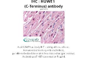 Image no. 1 for anti-HECT, UBA and WWE Domain Containing 1, E3 Ubiquitin Protein Ligase (HUWE1) antibody (ABIN1735641) (HUWE1 antibody)