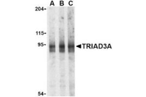Image no. 1 for anti-Ring Finger Protein 216 (RNF216) (Isoform 1), (N-Term) antibody (ABIN265155) (RNF216 antibody  (Isoform 1, N-Term))