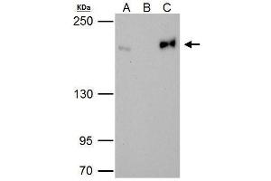 IP Image Topoisomerase II beta antibody immunoprecipitates Topoisomerase II beta protein in IP experiments. (TOP2B antibody  (C-Term))