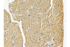 ABIN6258440 and ABIN6275234 at 1/100 staining mouse heart tissue by IHC-P.