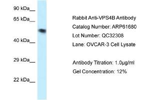 Western Blotting (WB) image for anti-Vacuolar Protein Sorting 4 Homolog B (vps4b) (N-Term) antibody (ABIN2774320) (VPS4B antibody  (N-Term))