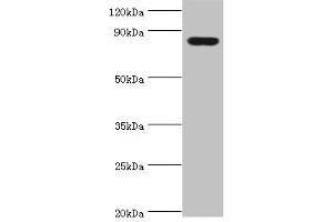 Western blot All lanes: Peroxisomal multifunctional enzyme type 2 antibody at 3 μg/mL + Mouse liver tissue Secondary Goat polyclonal to rabbit IgG at 1/10000 dilution Predicted band size: 80, 84, 78 kDa Observed band size: 80 kDa (HSD17B4 antibody  (AA 437-736))