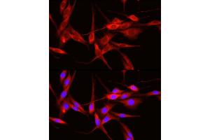 Immunofluorescence analysis of PC-12 cells using  Rabbit pAb (ABIN6131155, ABIN6136539, ABIN6136540 and ABIN6221035) at dilution of 1:50 (40x lens). (ADAM9 antibody  (AA 475-685))