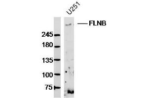 U251 lysates probed with FLNB Polyclonal Antibody, Unconjugated  at 1:300 dilution and 4˚C overnight incubation. (FLNB antibody  (AA 1551-1650))