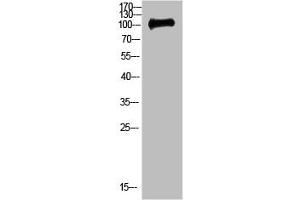 Western Blot analysis of 3T3 cells using Antibody diluted at 500. (CTNND1 antibody  (AA 841-890))
