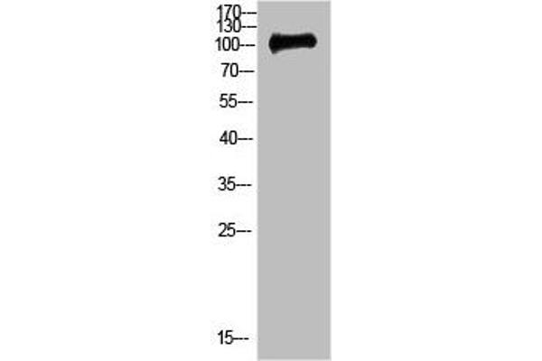 CTNND1 antibody  (AA 841-890)