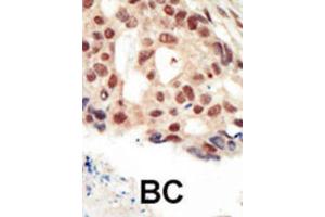 Immunohistochemistry (IHC) image for anti-Protein Kinase, CGMP-Dependent, Type II (PRKG2) antibody (ABIN3003619)