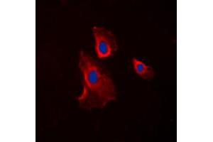Immunofluorescent analysis of Histamine H2 Receptor staining in COLO205 cells. (HRH2 antibody  (Center))