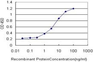 Detection limit for recombinant GST tagged GRK4 is approximately 0. (GRK4 antibody  (AA 36-145))