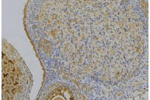ABIN6276997 at 1/100 staining Human gastric tissue by IHC-P. (HSD17B2 antibody  (C-Term))
