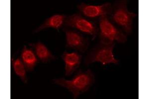 ABIN6272245 staining K562 by IF/ICC. (ARHGAP22 antibody  (C-Term))
