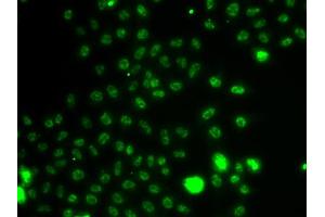 Immunofluorescence analysis of A549 cells using ETV1 antibody. (ETV1 antibody)