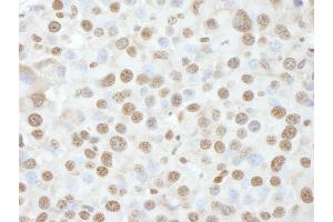 Immunohistochemistry (IHC) image for anti-Nuclear Casein Kinase and Cyclin-Dependent Kinase Substrate 1 (NUCKS1) (AA 1-50) antibody (ABIN7448993)