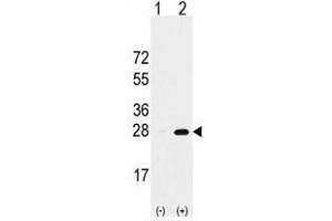 Image no. 1 for anti-Proteasome Subunit alpha 5 (PSMA5) (Middle Region) antibody (ABIN356946)