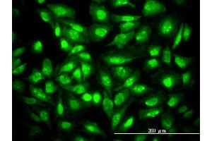 Immunofluorescence of monoclonal antibody to CDKN1B on HeLa cell. (CDKN1B antibody  (AA 1-198))