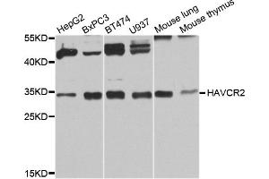 Western blot analysis of extracts of various cell lines, using HAVCR2 antibody (ABIN6291690) at 1:1000 dilution.