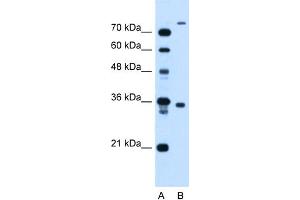 WB Suggested Anti-FLJ22167 Antibody Titration:  1. (FLJ22167 (N-Term) antibody)