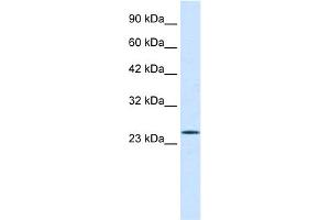 WB Suggested Anti-PCGF3 Antibody Titration:  0. (PCGF3 antibody  (Middle Region))