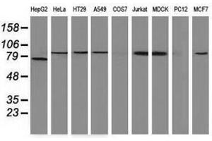 Image no. 3 for anti-Catenin (Cadherin-Associated Protein), beta 1, 88kDa (CTNNB1) antibody (ABIN1496891) (CTNNB1 antibody)