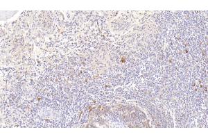 Detection of H-FABP in Human Spleen Tissue using Polyclonal Antibody to Heart-type Fatty Acid Binding Protein (H-FABP)