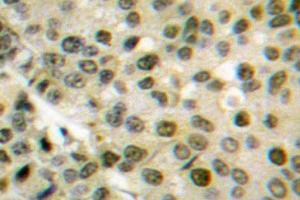Image no. 1 for anti-V-Akt Murine Thymoma Viral Oncogene Homolog 1 (AKT1) antibody (ABIN271867) (AKT1 antibody)
