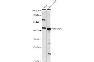 Western blot analysis of extracts of various cell lines, using PRPS antibody (ABIN7269364) at 1:1000 dilution. (PRPSAP1 antibody  (AA 30-110))