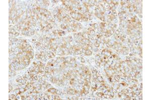 IHC-P Image Immunohistochemical analysis of paraffin-embedded MCF7 xenograft, using CSDE1, antibody at 1:250 dilution. (CDSE1 antibody  (Internal Region))