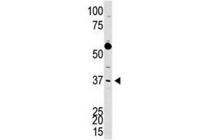 Image no. 1 for anti-DKK3 (N-Term) antibody (ABIN357071) (DKK3 antibody  (N-Term))