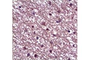 Immunohistochemical staining of formalin-fixed paraffin-embedded human heart showing staining with ANGPT1 polyclonal antibody  at 1:100 dilution. (Angiopoietin 1 antibody)