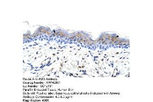 Human Skin (IRX3 antibody  (C-Term))