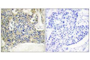 Immunohistochemistry (IHC) image for anti-Protein Kinase C, theta (PRKCQ) (pSer695) antibody (ABIN1847342) (PKC theta antibody  (pSer695))