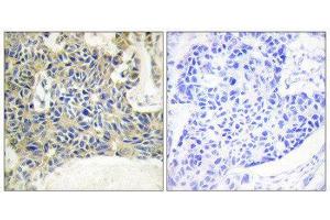 Immunohistochemistry (IHC) image for anti-Protein Kinase C, theta (PRKCQ) (pSer695) antibody (ABIN1847342)