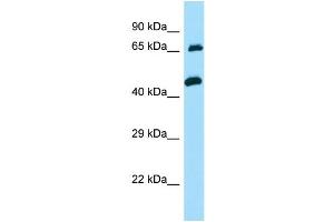 WB Suggested Anti-TXLNA Antibody Titration: 1. (alpha Taxilin antibody  (C-Term))