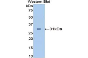 Western blot analysis of the recombinant protein. (CA2 antibody  (AA 1-260))