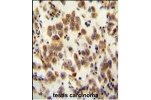 OR8B8 antibody (C-term) (ABIN654816 and ABIN2844489) immunohistochemistry analysis in formalin fixed and paraffin embedded human testis carcinoma followed by peroxidase conjugation of the secondary antibody and DAB staining. (OR8B8 antibody  (C-Term))