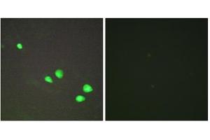 Immunofluorescence analysis of HepG2 cells, using CHD4 antibody. (CHD4 antibody  (Internal Region))