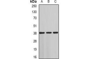 Western blot analysis of ST3GAL4 expression in HT29 (A), rat testis (B), rat liver (C) whole cell lysates.