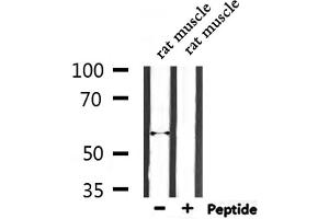 Western blot analysis of extracts from rat muscle, using ENDOD1 Antibody. (ENDOD1 antibody  (Internal Region))