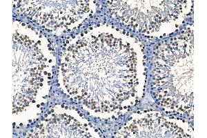 ABIN6265373 and ABIN6266661 at 1/100 staining Rat testis tissue by IHC-P.