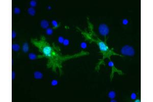 Rat brain neural cultures stained with (green) and DNA (blue). (Galectin 3 antibody)