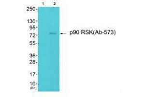 Western blot analysis of extracts from 293 cells (Lane 2), using p90 RSK (Ab-573) antiobdy. (RPS6KA1 antibody  (Thr573))
