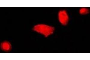 Immunofluorescent analysis of DCAF7 staining in U2OS cells. (DCAF7 antibody)