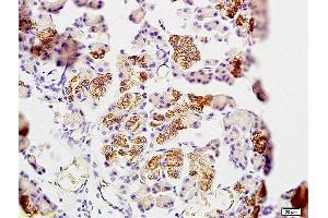 Formalin-fixed and paraffin embedded rat pancreas tissue labeled with Anti ORP150 Polyclonal Antibody, Unconjugated (ABIN705851) at 1:200 followed by conjugation to the secondary antibody and DAB staining (HYOU1 antibody  (AA 401-500))