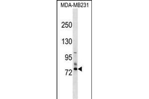 SCNN1D Antibody (N-term) (ABIN1539104 and ABIN2849251) western blot analysis in MDA-M cell line lysates (35 μg/lane). (SCNN1D antibody  (N-Term))
