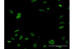 Immunofluorescence of monoclonal antibody to NEUROD6 on HeLa cell. (NEUROD6 antibody  (AA 191-290))