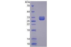 Figure. (CLCA1 Protein (AA 416-670) (His tag))