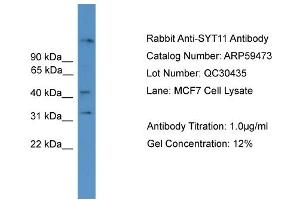 WB Suggested Anti-SYT11  Antibody Titration: 0. (SYT11 antibody  (N-Term))