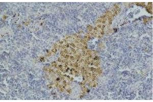 Immunohistochemistry of paraffin-embedded Mouse spleen tissue with CASP8 Monoclonal Antibody (Caspase 8 antibody)